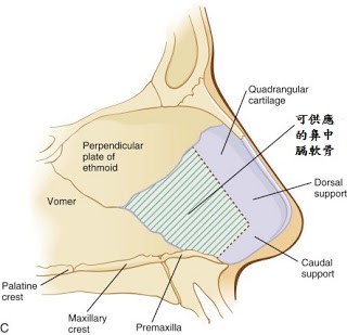 自體材料－鼻中膈軟骨