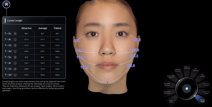 3D相機,3D模擬,術前模擬,術前術後照,隆鼻手術,雙眼皮手術,臉部手術