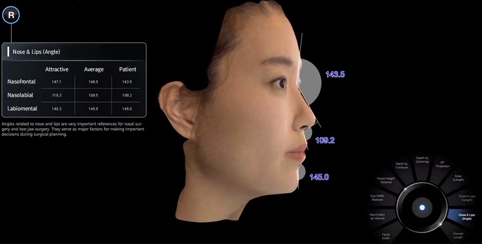 3D相機,3D模擬,術前模擬,術前術後照,隆鼻手術,雙眼皮手術,臉部手術