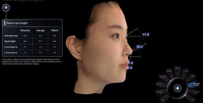 3D相機,3D模擬,術前模擬,術前術後照,隆鼻手術,雙眼皮手術,臉部手術