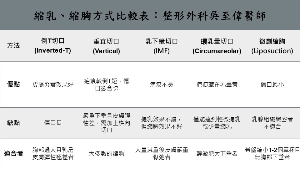 縮乳,縮胸,吳至偉醫師,凡登整形外科診所
