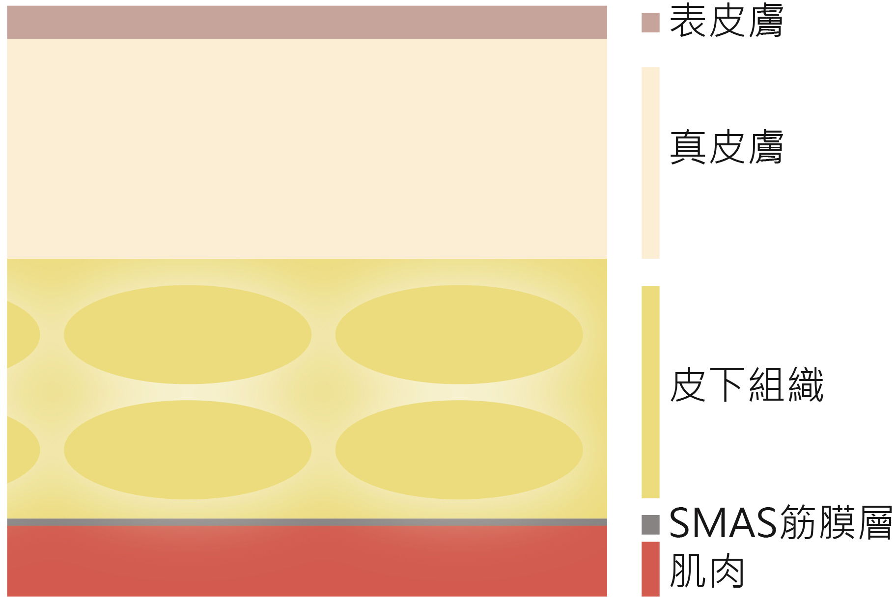 電波,音波,電波拉皮,音波拉皮,雙波拉皮