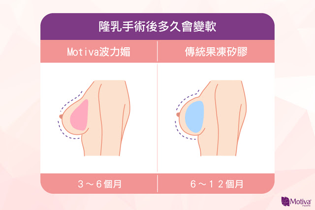 隆乳手術後多久會變軟