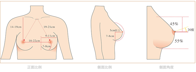 果凍矽膠隆乳完美的乳房比例