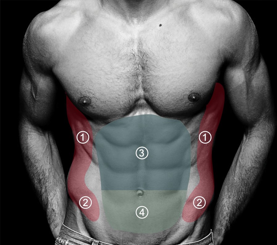 男性 腹部腰部抽脂手術