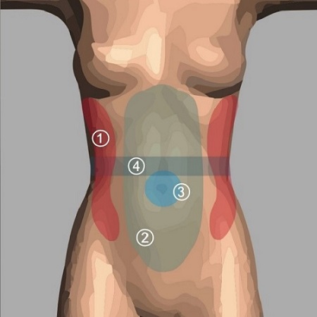 女性 腰部腹部抽脂手術