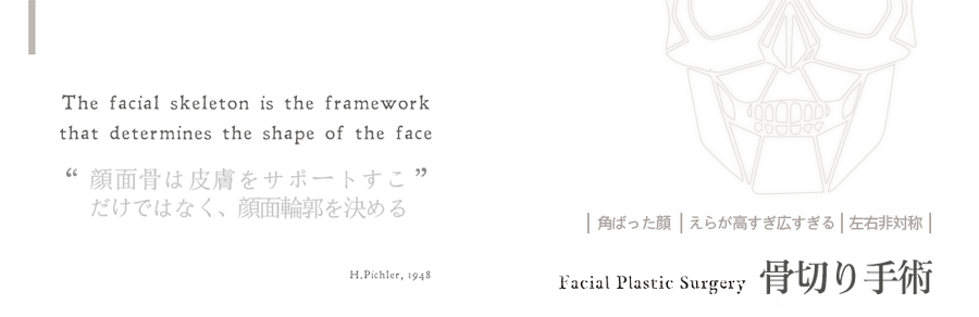 削骨,削骨手術,國字臉削骨,顴骨過高過寬,大小臉削骨手術 削骨,削骨手術,國字臉削骨,顴骨過高過寬,大小臉削骨手術