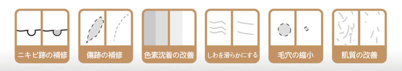 飛梭