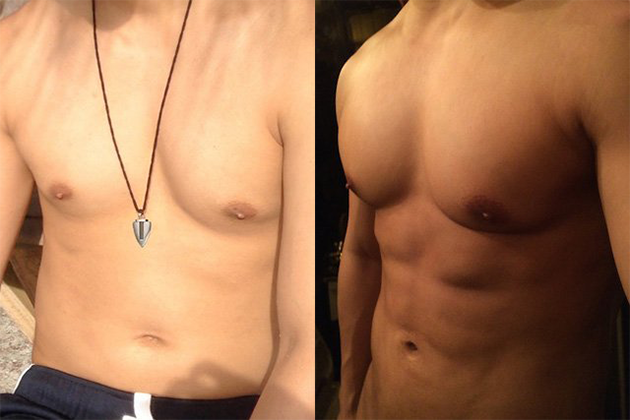 抽脂體雕新概念 - 淺層脂肪控制術 - 馮中和院長