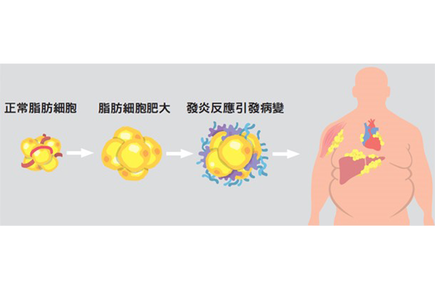 健身減肥 vs. 抽脂手術 - 馮中和院長