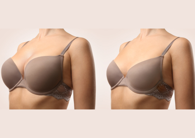 隆乳老化會變怎樣？隆乳老化現象與隆乳效果維持秘訣大公開！