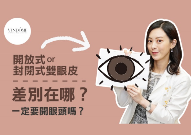 內雙外雙差別在哪怎麼分？割雙眼皮要怎麼用的好看？