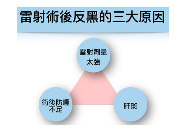 預防雷射除斑反黑不能不知道的三件事