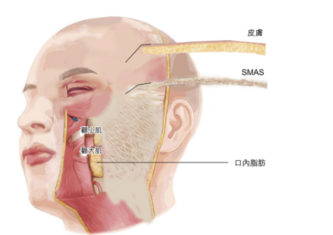 脫離舊有觀念的「2025拉皮嶄新概念」（下）個人化三層拉皮手術設計
