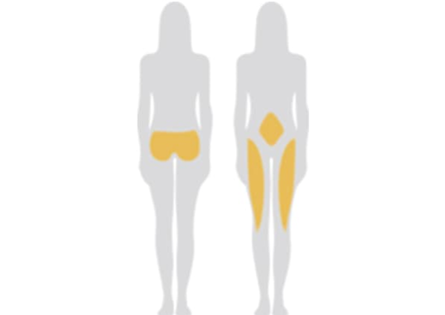 自體脂肪隆乳所使用的脂肪可以來自於哪裡？效果有差別嗎？