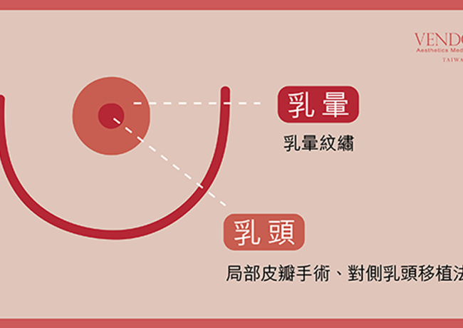 乳房重建的最後一哩路 乳頭乳暈重建