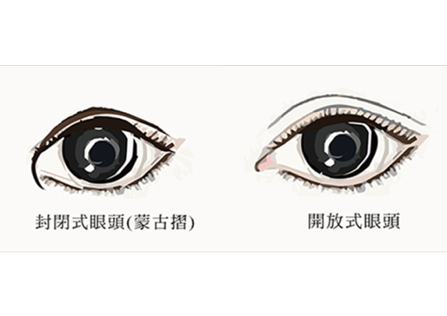 封閉式眼頭 or 開放式眼頭