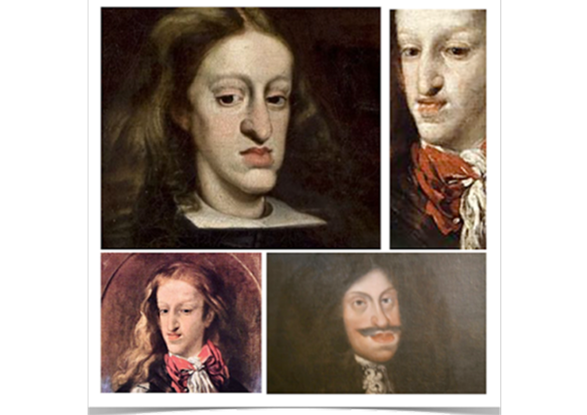 我的下巴可以掛東西 : Habsburg Jaw
