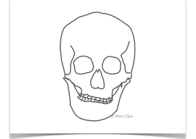顏面歪斜 Facial asymmetry: 2D V.S 3D