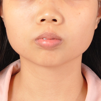 下巴太短，臉型較方